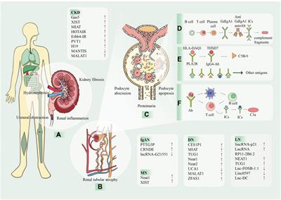 Kidney diseases and long non-coding RNAs in the limelight